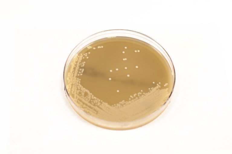 Egg Yok Agar EYA Anaerobe Systems