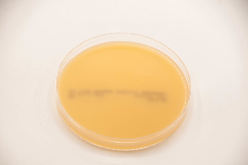 Egg Yok Agar EYA Anaerobe Systems